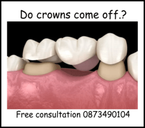 Do crowns come off image