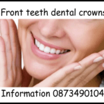 Front teeth dental crowns image