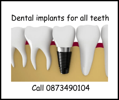 Dental implants for all teeth image 2