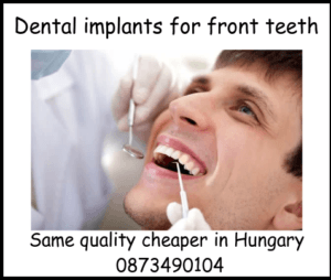 Dental implants for front teeth image