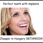 Perfect teeth with implants image