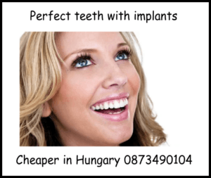 Perfect teeth with implants image