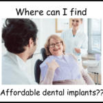 Where can I get affordable dental implants image