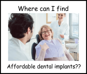 Where can I get affordable dental implants image