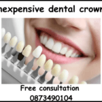 Inexpensive dental crowns image 1