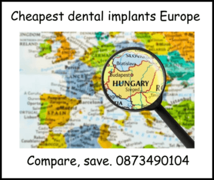 Cheapest dental implants in Europe