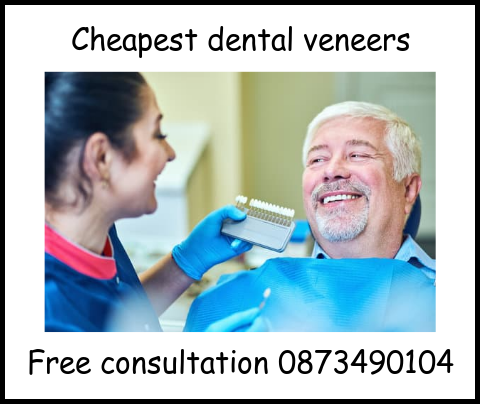 Cheapest dental veneers image