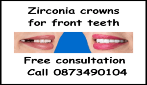 Zirconia crowns front teeth image