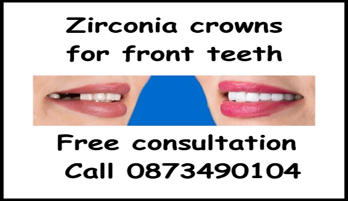 Zirconia crowns for front teeth image 1