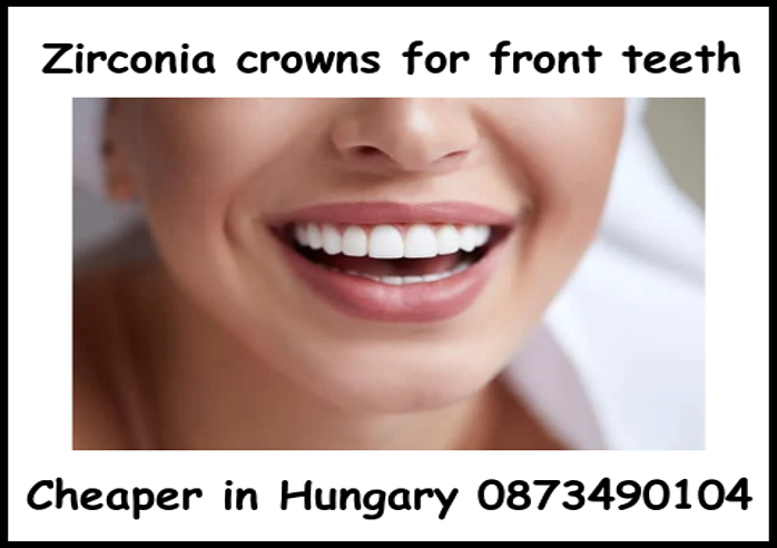 Zirconia crowns for front teeth image 2