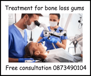 Treatment for bone loss gums image