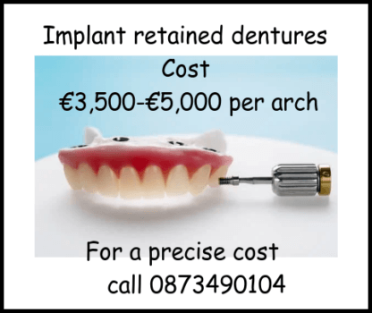 Implant retained dentures cost