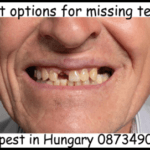 Best options for missing teeth image