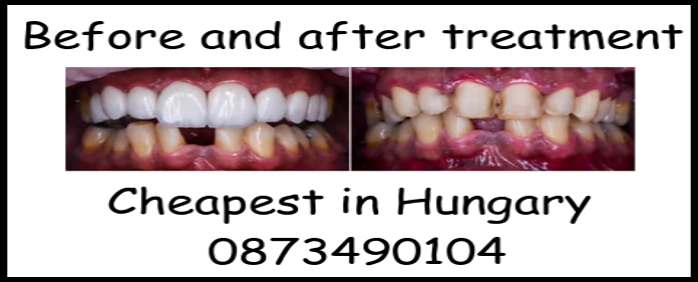 Before and after treatment image