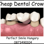 Cheap dental crown image
