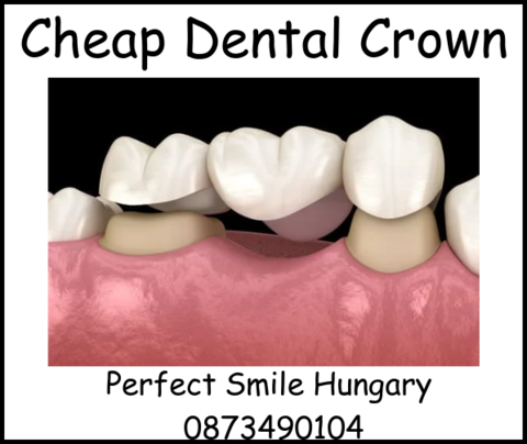 Cheap dental crown image