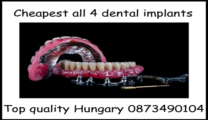 Cheapest all 4 dental implants image