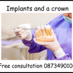 Implants and a crown image