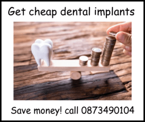 Get cheap dental implants image