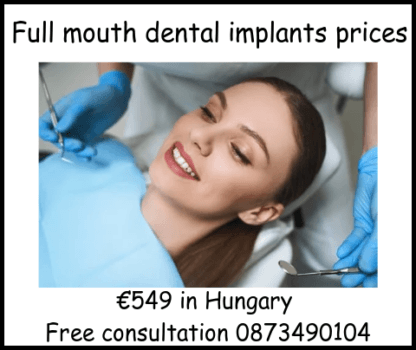 Full mouth dental implants prices