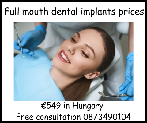 Full mouth dental implants prices image