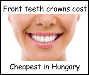 Front teeth crowns cost hungary