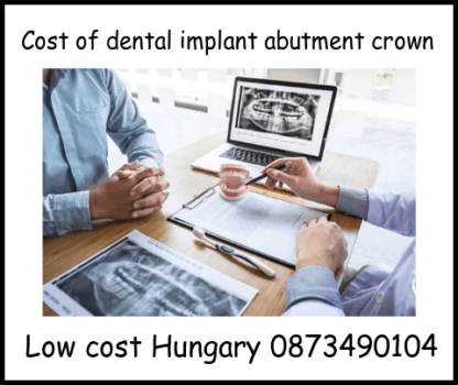 Cost Of Dental Implant Abutment Crown