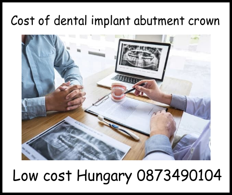 Cost dental implant abutment crown image