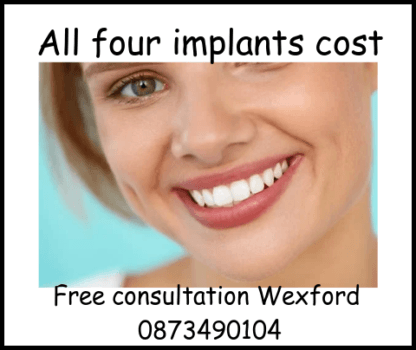 All four implants cost image