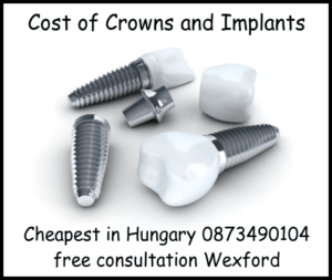 Cost of crowns and implants image