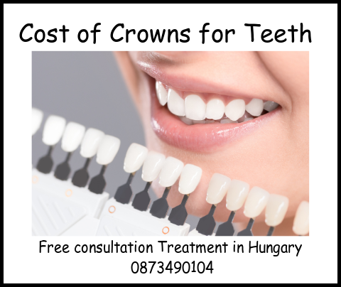 Cost of crowns for teeth image