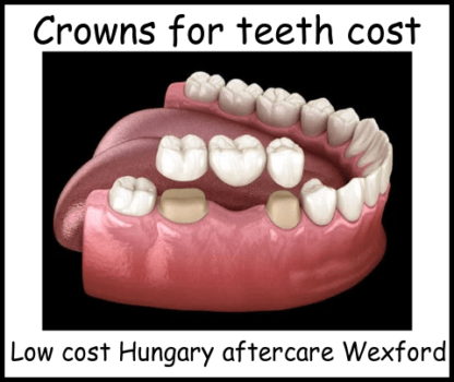 Crowns for teeth cost image