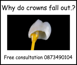 Why do crowns fall out image