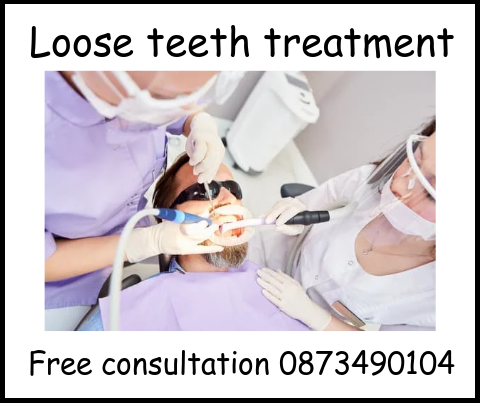 Loose teeth treatment image 