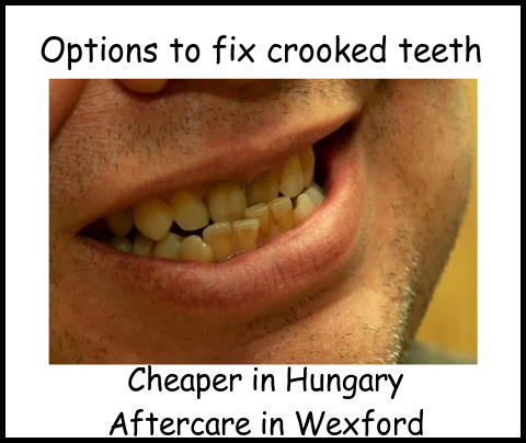 Options to fix crooked teeth image