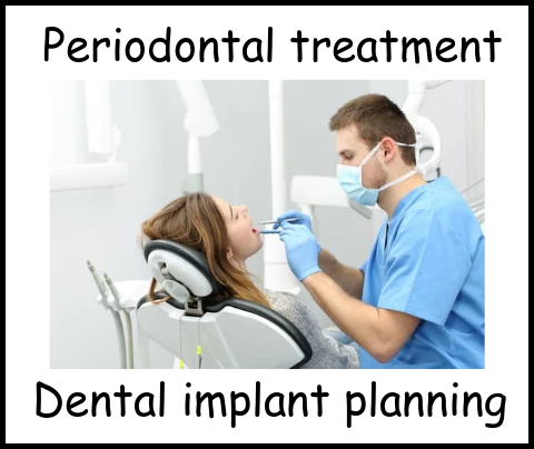Periondontal treatment dental implant planning image