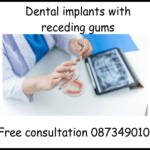 Dental implants with receding gums image