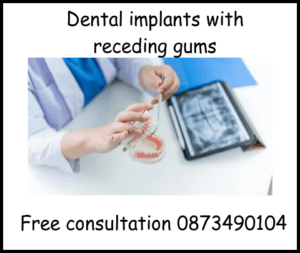 Dental implants with receding gums image