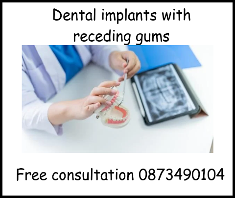 Dental implants with receding gums image