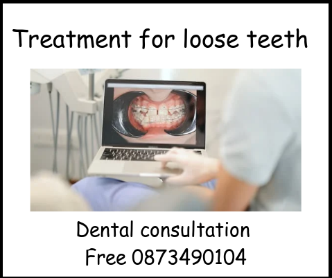 Treatment for loose teeth image