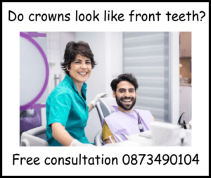 Do crowns look like front teeth image