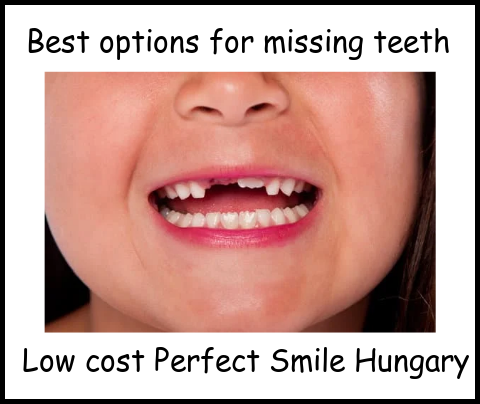 Best options for missing teeth low cost Perfect Smile Hungary image