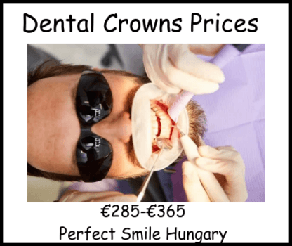 Dental crowns prices image