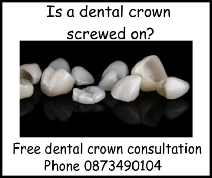 Is a dental crown screwed on
