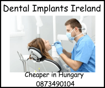 Dental implants Ireland image