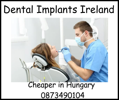 Dental implants Ireland image