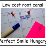 Low cost root canal treatment Perfect Smile Hungary image