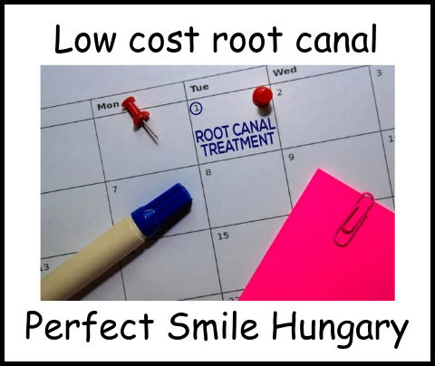 Low cost root canal treatment Perfect Smile Hungary image