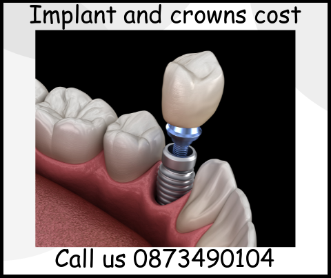 Implant and crowns cost Hungary image 