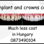Implant and crowns cost image